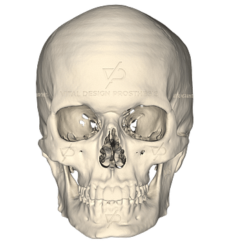 Vista frontal de paciente que se quiso colocar aumento facial personalizado en ángulo mandibular.